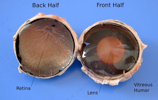 The front and back halves of a dissected eyeball, showing the retina and vitreous body