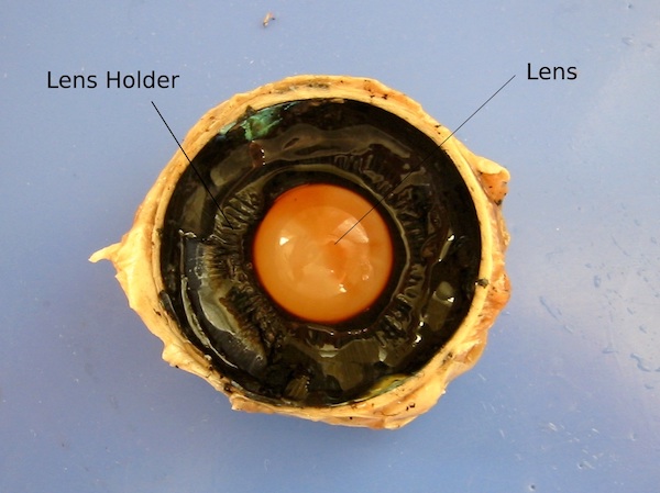 The interior of a dissected eyeball, showing the crystalline lens, and the ciliary body