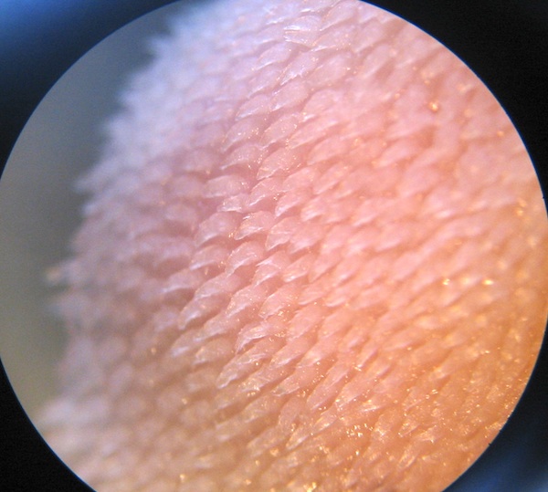The papillae of a lamb's tongue, seen through a low power microscope